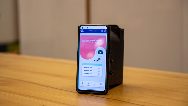 iLenz app and 3D printed prototype